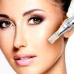 Microneedling